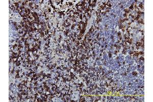 Immunoperoxidase of monoclonal antibody to CD3Z on formalin-fixed paraffin-embedded human lymph node tissue. (CD247 antibody  (AA 1-164))