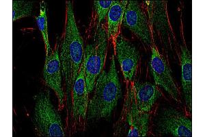 Western Blotting analysis (reducing conditions) of human Sos using anti-Sos (SOS-01). (Sos antibody)