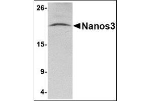 Western blot analysis of Nanos3 in human brain tissue lysate with this product at 2 μg/ml. (NANOS3 antibody  (C-Term))