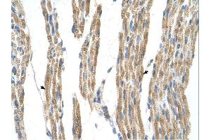 Immunohistochemistry (IHC) image for anti-Alanine Aminotransferase (ALT) (N-Term) antibody (ABIN2782333) (ALT antibody  (N-Term))