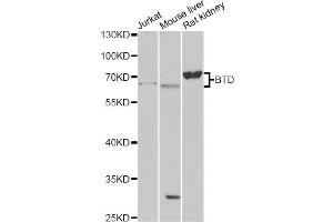 Western blot analysis of extracts of various cell lines, using BTD antibody (ABIN6290108) at 1:1000 dilution.