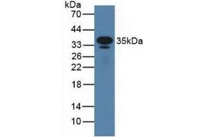 Detection of CD23 in Mouse Serum using Polyclonal Antibody to Cluster Of Differentiation 23 (CD23) (FCER2 antibody  (AA 150-330))