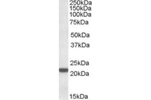 Western Blotting (WB) image for anti-Proteasome (Prosome, Macropain) Subunit, beta Type, 8 (Large Multifunctional Peptidase 7) (PSMB8) (C-Term) antibody (ABIN2464158) (PSMB8 antibody  (C-Term))