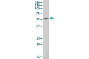 NPR3 polyclonal antibody (A01), Lot # UHB5051129QCS1 Western Blot analysis of NPR3 expression in HeLa . (NPR3 antibody  (AA 42-140))