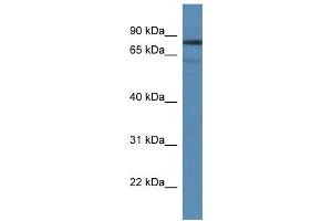 WB Suggested Anti-Tdp1 Antibody Titration: 1. (TDP1 antibody  (Middle Region))