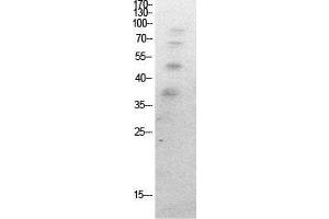 Western Blot (WB) analysis of HeLa cells using Acetyl-Ub (K27) Polyclonal Antibody. (Ubiquitin antibody  (acLys27))