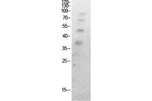 Western Blot (WB) analysis of HeLa cells using Acetyl-Ub (K27) Polyclonal Antibody.