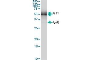 Immunoprecipitation of PUS1 transfected lysate using anti-PUS1 MaxPab rabbit polyclonal antibody and Protein A Magnetic Bead , and immunoblotted with PUS1 MaxPab rabbit polyclonal antibody (D01) . (PUS1 antibody  (AA 1-399))