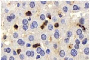 Immunohistochemistry (Paraffin-embedded Sections) (IHC (p)) image for anti-CD63 (CD63) antibody (ABIN7073400)