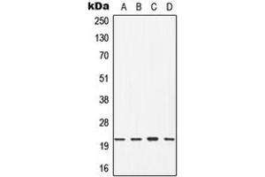 Western blot analysis of CDC42 expression in Jurkat (A), HT29 (B), mouse brain (C), rat liver (D) whole cell lysates. (CDC42 antibody  (Center))