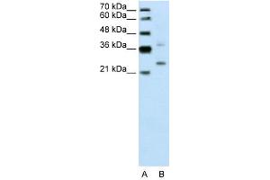 WB Suggested Anti-DCUN1D1  Antibody Titration: 0. (DCUN1D1 antibody  (N-Term))