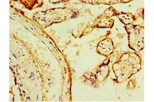 Immunohistochemistry of paraffin-embedded human placenta tissue using ABIN7166413 at dilution of 1:100 (Transglutaminase 2 antibody  (AA 438-687))