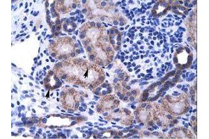 Image no. 1 for anti-Zinc Finger Protein 84 (ZNF84) (C-Term) antibody (ABIN202890) (ZNF84 antibody  (C-Term))