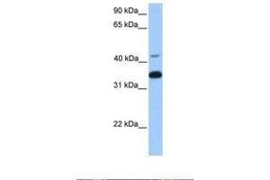 Image no. 1 for anti-Guanine Nucleotide Binding Protein (G Protein), beta Polypeptide 2 (GNB2) (AA 148-197) antibody (ABIN6738439) (GNB2 antibody  (AA 148-197))