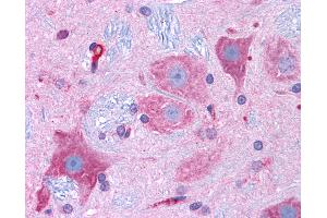 Immunohistochemistry (IHC) image for anti-Calcium Channel, Voltage-Dependent, L Type, alpha 1D Subunit (CACNA1D) (AA 859-875) antibody (ABIN604999)