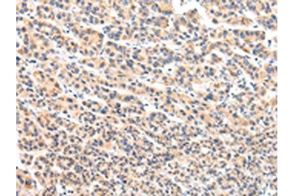 VPS54 antibody