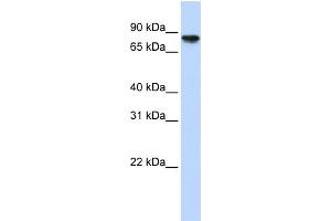 WB Suggested Anti-GYS2 Antibody Titration:  0.
