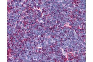 Anti-MAP3K7 / TAK1 antibody IHC of human thymus. (MAP3K7 antibody  (N-Term))