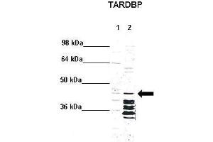 WB Suggested Anti-TARDBP Antibody  Positive Control: Lane 1: 5ug mouse brain cytoplasm Lane 2: 5ug mouse brain nucleus  Primary Antibody Dilution :  1:1000 Secondary Antibody : Anti rabbit - IR-dye Secondry Antibody Dilution :  1:10,000  Submitted by: Anonymous (TARDBP antibody  (N-Term))