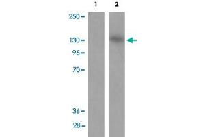Western blot analysis of Lane 1: antigen-specific peptide treated JK cells, Lane 2: JK cells with MAP3K1 (phospho T1400) polyclonal antibody  . (MAP3K1 antibody  (pThr1400))