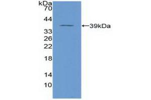Detection of Recombinant NFkB, Human using Polyclonal Antibody to Nuclear Factor Kappa B (NFkB) (NFkB antibody  (AA 42-367))
