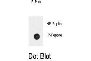 Dot blot analysis of anti-Phospho-BAR2-p Antibody (ABIN389931 and ABIN2839749) on nitrocellulose membrane. (BAR2 antibody  (pSer261))