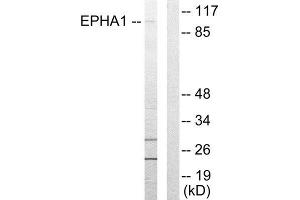 Western Blotting (WB) image for anti-Ephrin Type A Receptor 1 (EPHA1) (Internal Region) antibody (ABIN1849247) (EPHA1 antibody  (Internal Region))