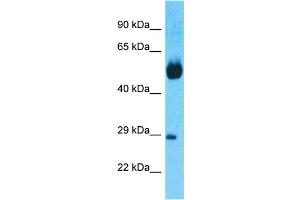 Host:  Rabbit  Target Name:  NR1H4  Sample Tissue:  Human Lung Tumor  Antibody Dilution:  1ug/ml (NR1H4 antibody  (N-Term))