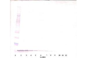 Image no. 3 for anti-Epidermal Growth Factor (EGF) antibody (ABIN465058) (EGF antibody)