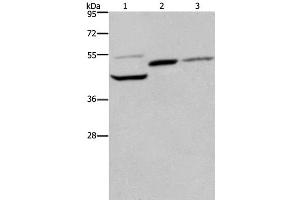 Western Blot analysis of Mouse heart, kidney and liver tissue using CYR61 Polyclonal Antibody at dilution of 1:350 (CYR61 antibody)