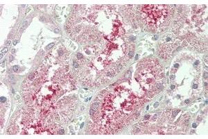 Detection of KLb in Human Kidney Tissue using Polyclonal Antibody to Klotho Beta (KLb) (Klotho beta antibody  (AA 517-636))