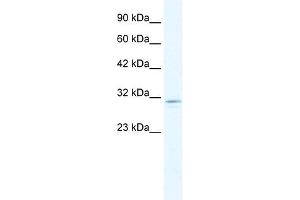 CLIC2 antibody used at 1. (CLIC2 antibody  (C-Term))