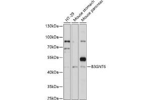 Western blot analysis of extracts of various cell lines, using B3GNT6 antibody (ABIN7271206) at 1:1000 dilution. (B3GNT6 antibody  (AA 30-200))