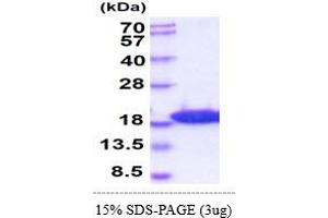 SDS-PAGE (SDS) image for Microtubule-Associated Protein 1 Light Chain 3 beta (MAP1LC3B) (AA 1-120) protein (His tag) (ABIN5854997) (LC3B Protein (AA 1-120) (His tag))