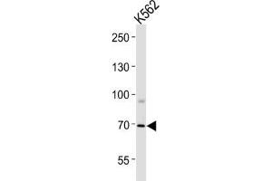 Western Blotting (WB) image for anti-Forkhead Box K1 (Foxk1) antibody (ABIN3004358) (Foxk1 antibody)