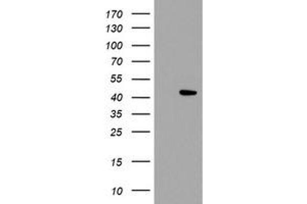 LDAH/C2orf43 antibody