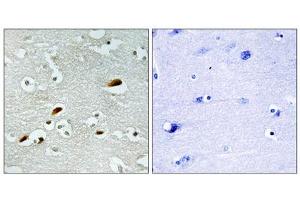 Immunohistochemistry analysis of paraffin-embedded human brain tissue, using TIP60 antibody. (KAT5 antibody  (Internal Region))