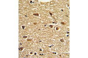 Immunohistochemistry (IHC) image for anti-Ets Variant 4 (ETV4) antibody (ABIN3002727) (ETV4 antibody)