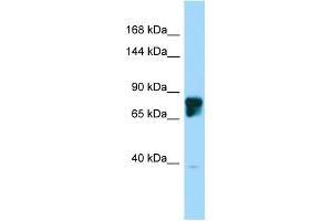 Host: Rabbit Target Name: SLITRK4 Sample Type: 721_B Whole Cell lysates Antibody Dilution: 1. (SLITRK4 antibody  (C-Term))
