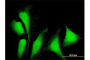 Immunofluorescence of purified MaxPab antibody to G3BP1 on HeLa cell. (G3BP1 antibody  (AA 1-466))