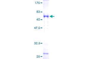 NDE1 Protein (NDE1) (AA 1-335) (GST tag)
