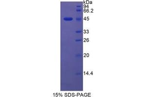 SDS-PAGE analysis of Rat Lipocalin 5 Protein. (LCN5 Protein)