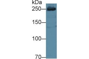 Detection of FASN in Human HepG2 cell lysate using Polyclonal Antibody to Fatty Acid Synthase (FASN) (Fatty Acid Synthase antibody  (AA 2263-2512))