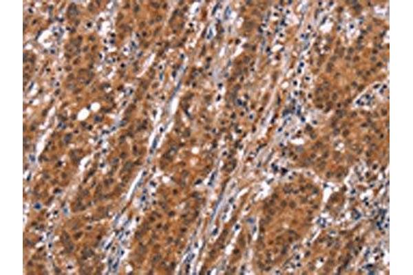 SLC8A2 antibody