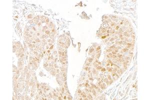 Immunohistochemistry (IHC) image for anti-Mediator Complex Subunit 1 (MED1) (C-Term) antibody (ABIN7453585) (MED1 antibody  (C-Term))