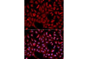 Immunofluorescence analysis of U2OS cell using SIAH1 antibody. (SIAH1 antibody  (AA 1-313))