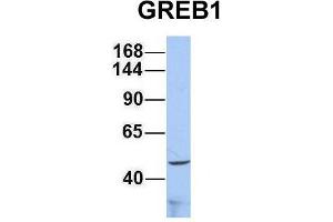 Host:  Rabbit  Target Name:  GREB1  Sample Type:  293T  Antibody Dilution:  1. (GREB1 antibody  (Middle Region))