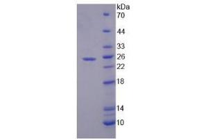 Image no. 1 for Secreted Phosphoprotein 2 (SPP2) (AA 30-211) protein (His tag) (ABIN6237834) (SPP2 Protein (AA 30-211) (His tag))