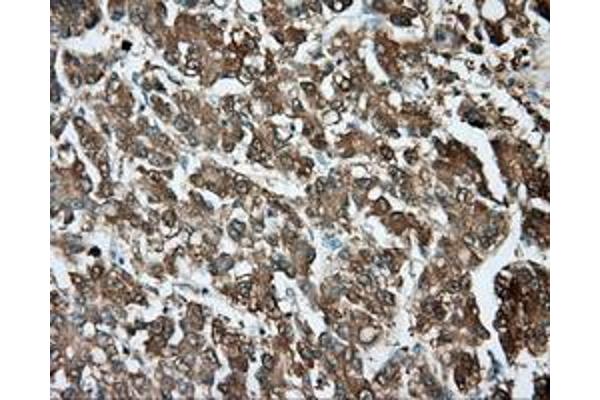 TPMT antibody
