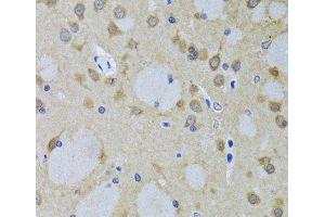 Immunohistochemistry of paraffin-embedded Mouse brain using YWHAZ Polyclonal Antibody at dilution of 1:100 (40x lens). (14-3-3 zeta antibody)